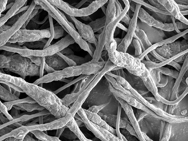 鋰電池爆炸頻發 新技術能0.4秒控制火情